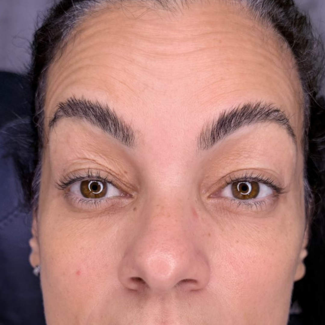 Depois do procedimento